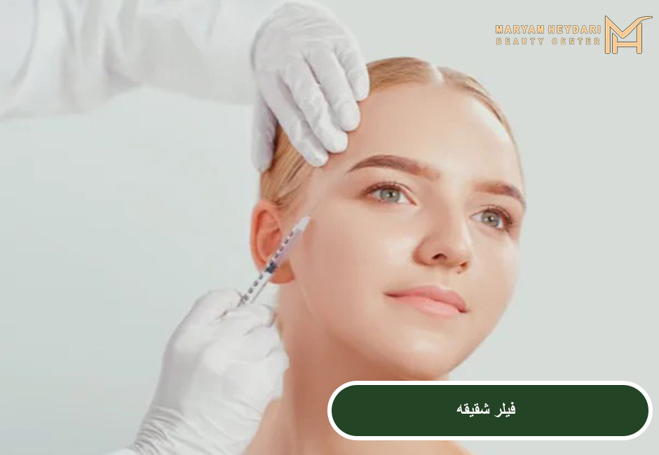 فیلر شقیقه