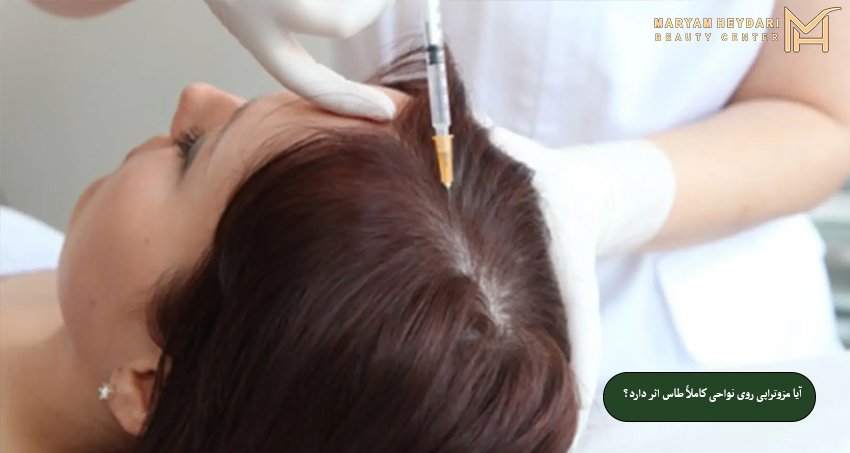 ترکیبات و کوکتل‌های مزوتراپی که معمولاً استفاده می‌شود