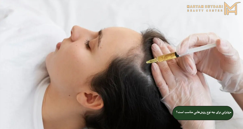 مزوتراپی برای چه نوع ریزش‌هایی مناسب است؟