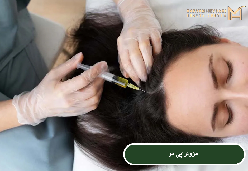 مزوتراپی مو