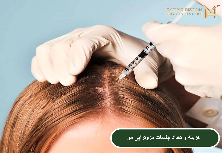 هزینه و تعداد جلسات مزوتراپی مو
