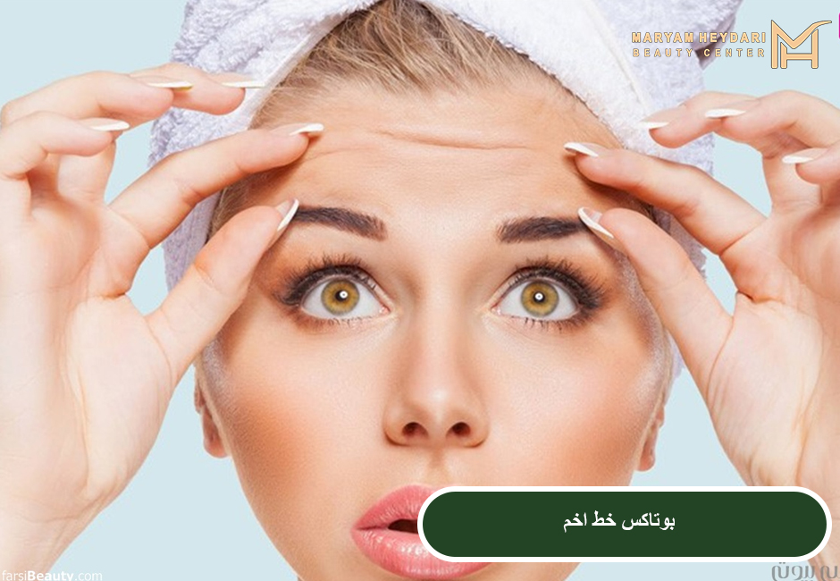 بوتاکس خط اخم