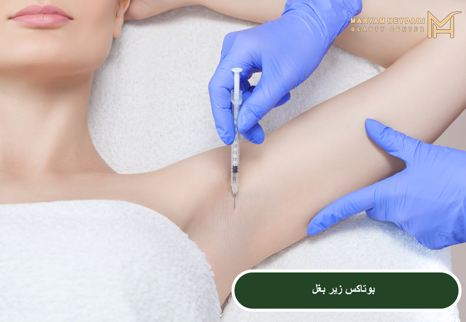 بوتاکس زیر بغل