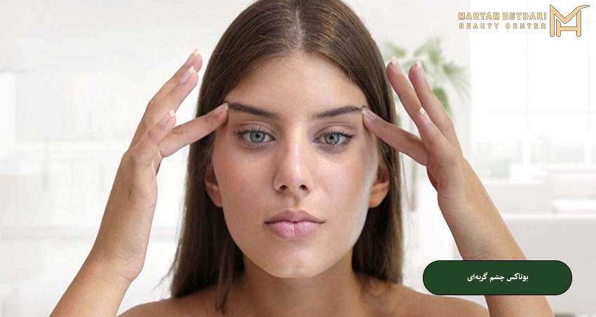 بوتاکس چشم گربه‌ای