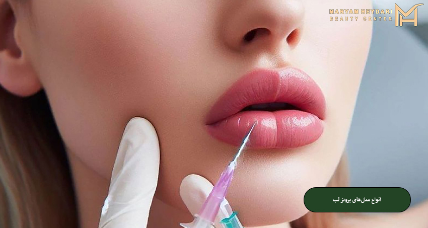 انواع مدل‌های پروتز لب