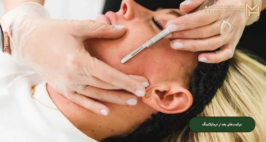 مراقبت‌های بعد از درماپلانینگ