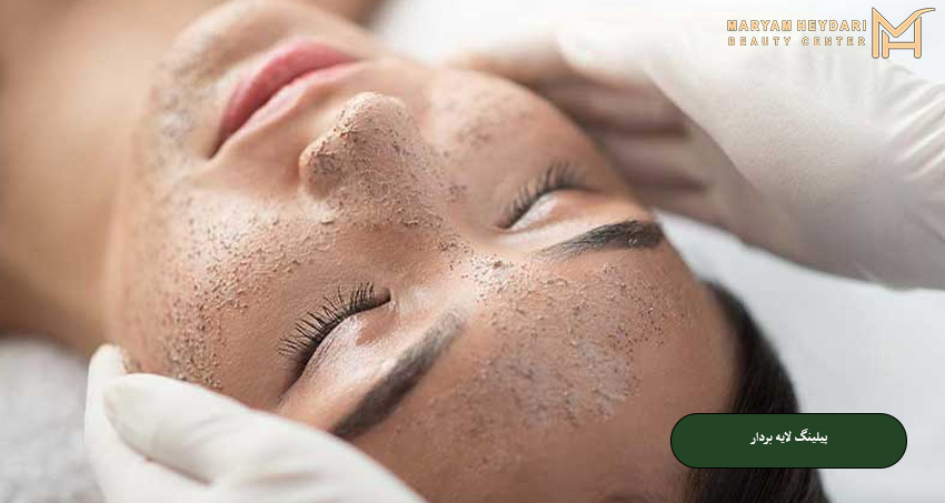 پیلینگ لایه ‌بردار