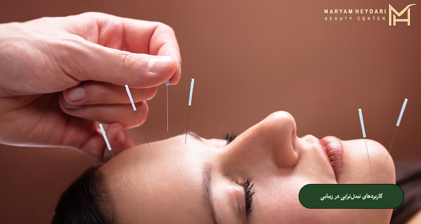 کاربردهای نیدل ‌تراپی در زیبایی