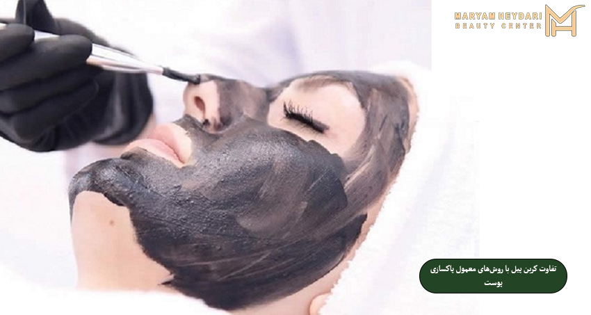 تفاوت کربن پیل با روش‌های معمول پاکسازی پوست