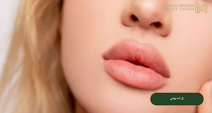 ژل لب روسی
